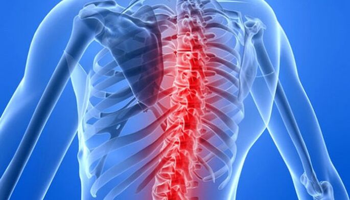 Các bệnh lý cột sống là nguyên nhân phổ biến nhất gây đau lưng vùng bả vai