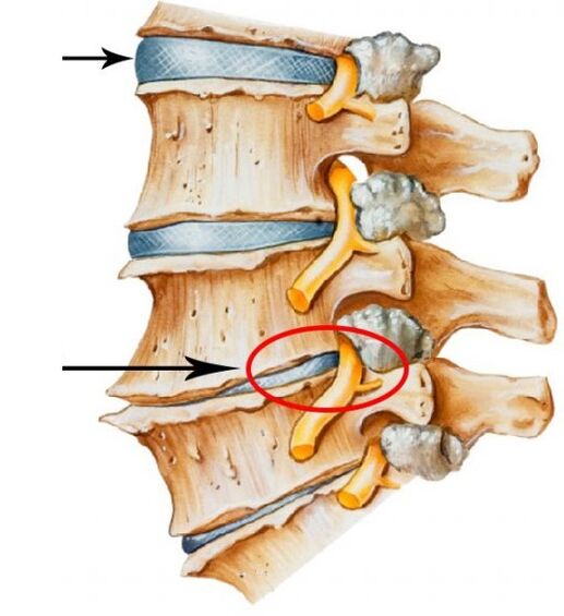 xương cổ tử cung