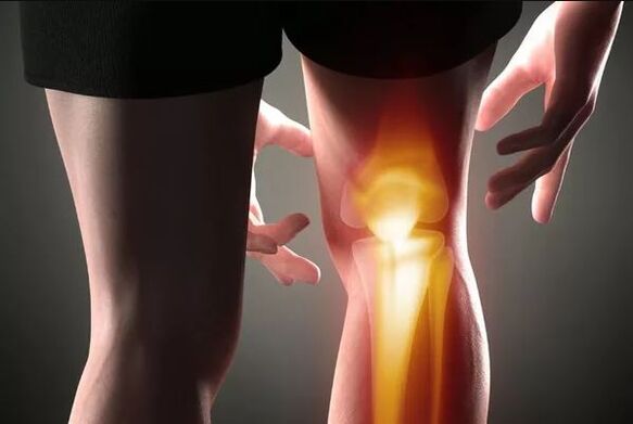 Arthrosis của khớp gối