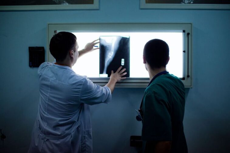 Chẩn đoán bệnh viêm khớp trên X -Ray