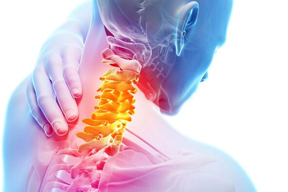 Thoái hóa xương cổ