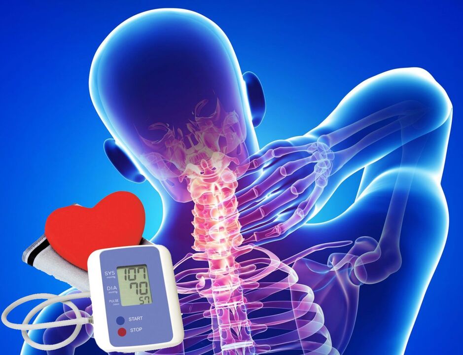Tăng huyết áp do thoái hóa đốt sống cổ
