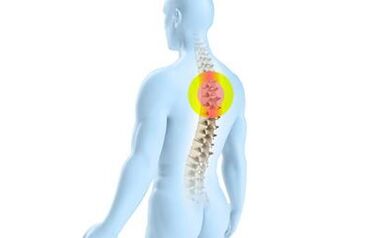thoái hóa xương cột sống ngực
