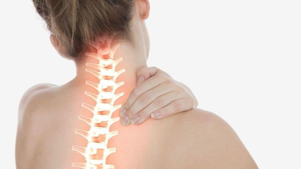 Với thoái hóa xương cột sống cổ, hội chứng rễ thần kinh có thể phát triển